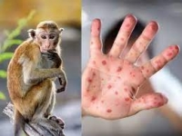 🐵BỆNH ĐẬU MÙA KHỈ VÀ CÁC BIỆN PHÁP PHÒNG TRÁNH🦠🦠🦠 ❗